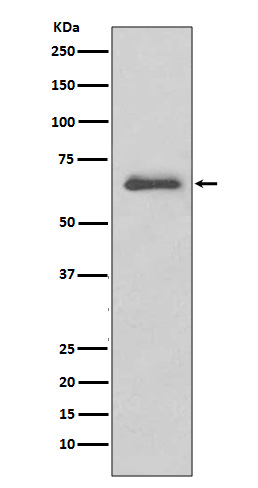 IRAK-M Antibody in Western Blot (WB)