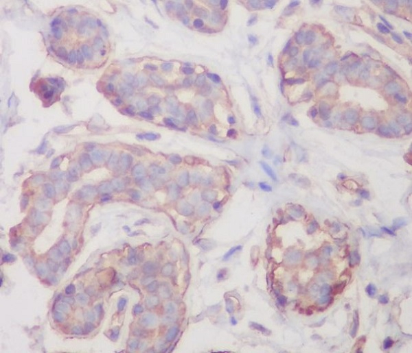 RALBP1 Antibody in Immunohistochemistry (Paraffin) (IHC (P))