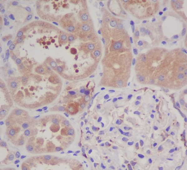 GARS Antibody in Immunohistochemistry (Paraffin) (IHC (P))
