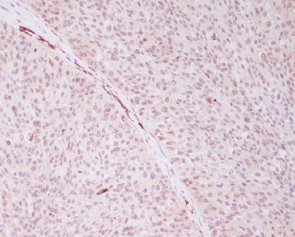 PRP19 Antibody in Immunohistochemistry (Paraffin) (IHC (P))