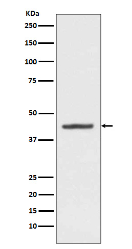 HMBS Antibody in Western Blot (WB)