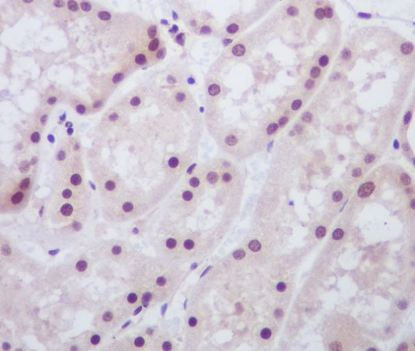 MAD2L1BP Antibody in Immunohistochemistry (Paraffin) (IHC (P))