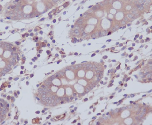 WAVE2 Antibody in Immunohistochemistry (Paraffin) (IHC (P))