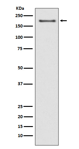 NSD3 Antibody in Western Blot (WB)