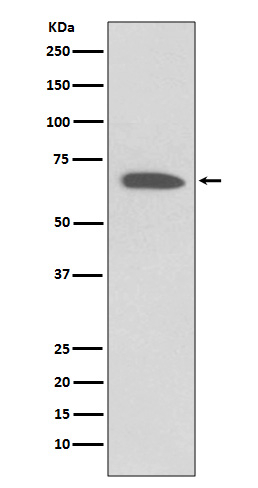 KV1.1 (KCNA1) Antibody in Western Blot (WB)
