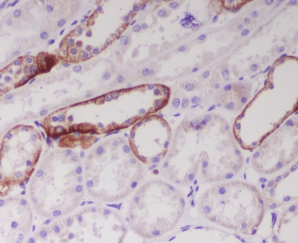 Jagged1 Antibody in Immunohistochemistry (Paraffin) (IHC (P))