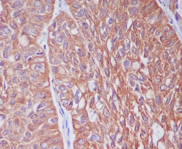 Cytokeratin 6A Antibody in Immunohistochemistry (Paraffin) (IHC (P))