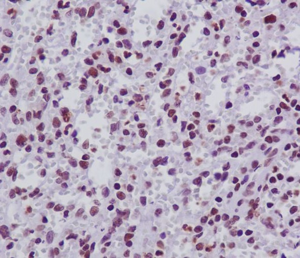 FANCD2 Antibody in Immunohistochemistry (Paraffin) (IHC (P))