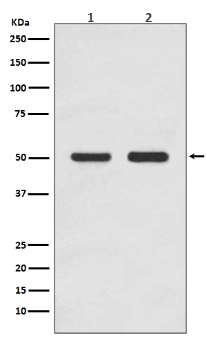AP2M1 Antibody in Western Blot (WB)