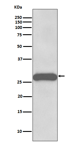 PPP1R1A Antibody in Western Blot (WB)