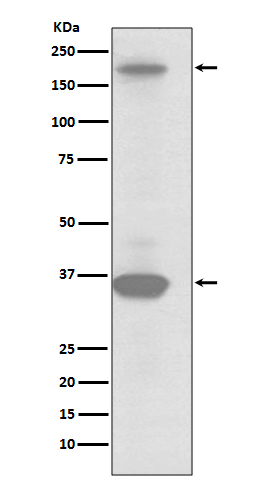 RON Antibody in Western Blot (WB)