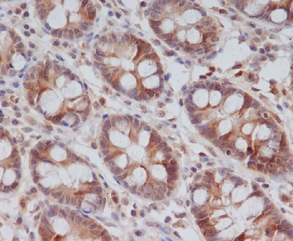 Cyclin B2 Antibody in Immunohistochemistry (Paraffin) (IHC (P))