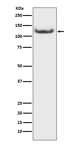 HDAC7 Antibody in Western Blot (WB)