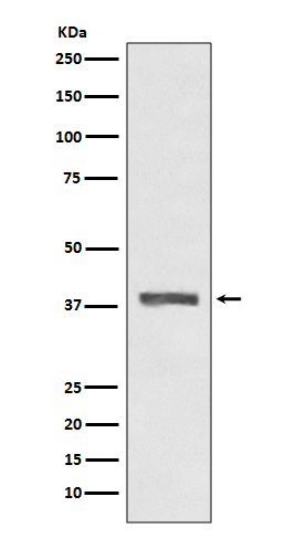 AMPK beta-1 Antibody in Western Blot (WB)