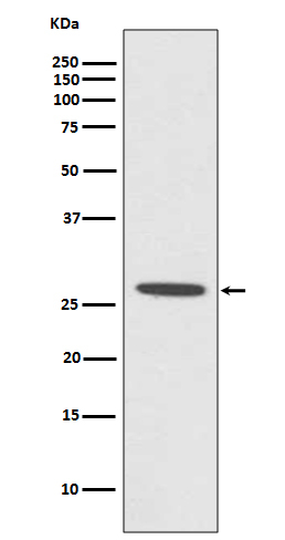 CDCA3 Antibody in Western Blot (WB)