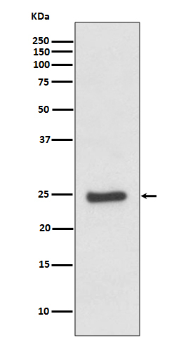 ZNRF2 Antibody in Western Blot (WB)
