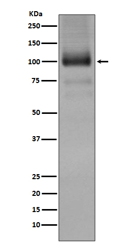 mGluR1 Antibody in Western Blot (WB)