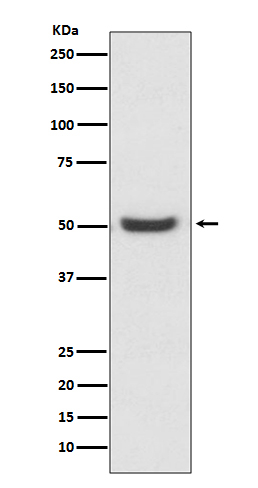 PDIA6 Antibody in Western Blot (WB)