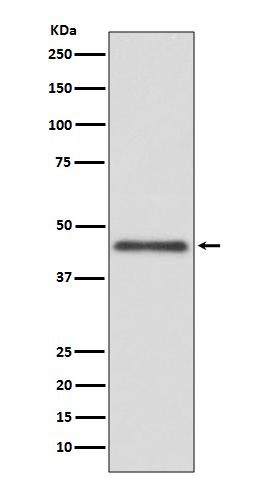 HLA-G Antibody in Western Blot (WB)