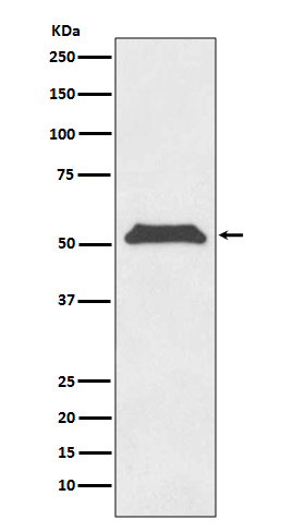 TRF1 Antibody in Western Blot (WB)