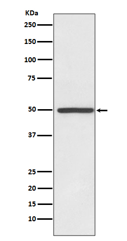 Dopamine Transporter Antibody in Western Blot (WB)