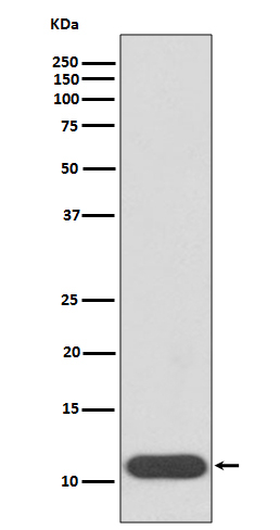 Hemoglobin gamma-1,2 Antibody in Western Blot (WB)