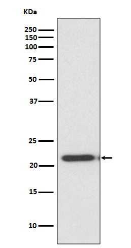 TIMP2 Antibody in Western Blot (WB)