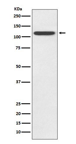 TLR5 Antibody in Western Blot (WB)