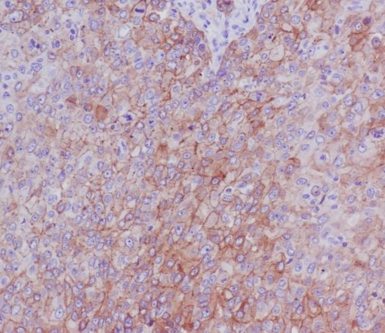 CD104 (Integrin beta 4) Antibody in Immunohistochemistry (Paraffin) (IHC (P))