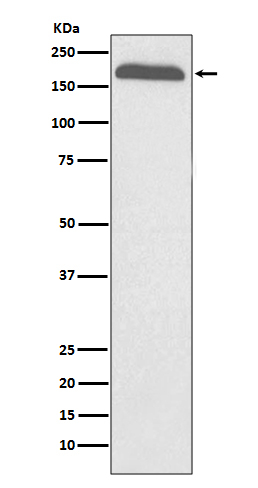 A2M Antibody in Western Blot (WB)