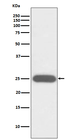 G-CSF Antibody in Western Blot (WB)