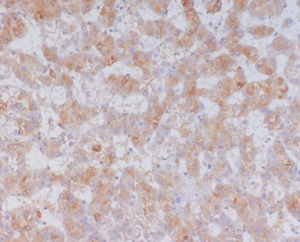 SAA Antibody in Immunohistochemistry (Paraffin) (IHC (P))