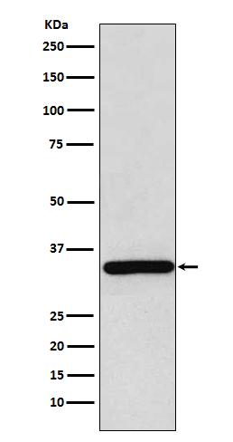 SGCG Antibody in Western Blot (WB)