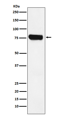 HEC1 Antibody in Western Blot (WB)