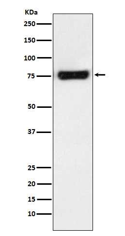 MTA2 Antibody in Western Blot (WB)