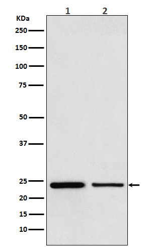 TBPL1 Antibody in Western Blot (WB)