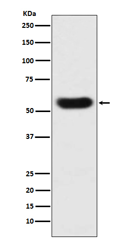 SERPINC1 Antibody in Western Blot (WB)