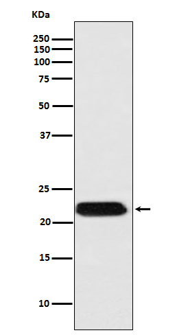 FTMT Antibody in Western Blot (WB)