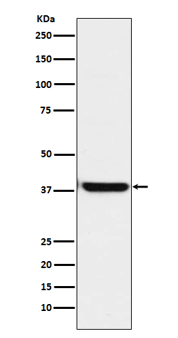 OGG1 Antibody in Western Blot (WB)