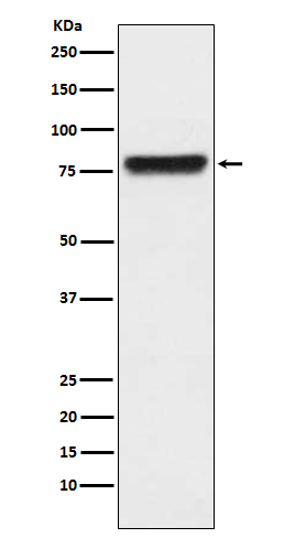 Plasma Kallikrein Antibody in Western Blot (WB)