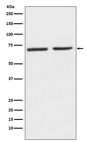 HTR2C Antibody in Western Blot (WB)
