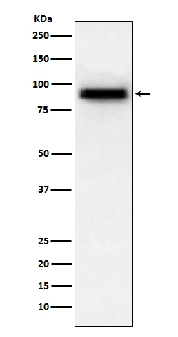 PDE4D Antibody in Western Blot (WB)