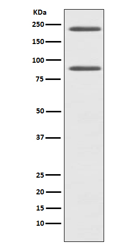 Complement C4a Antibody in Western Blot (WB)