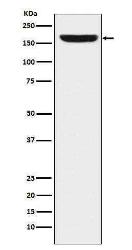 REST Antibody in Western Blot (WB)