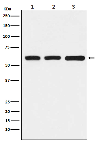 ELP3 Antibody in Western Blot (WB)