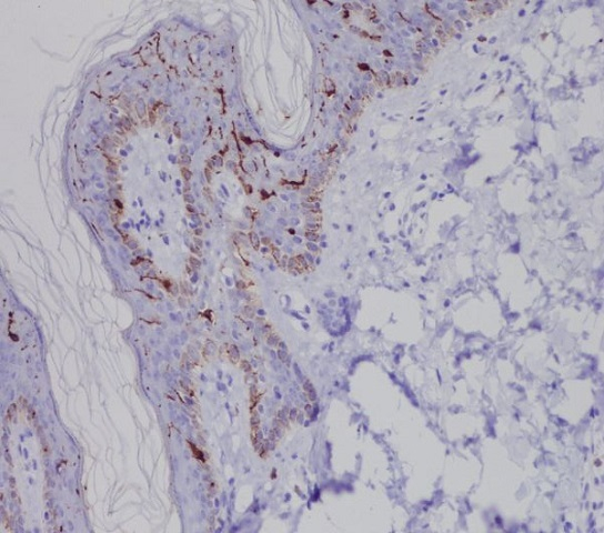 Langerin Antibody in Immunohistochemistry (Paraffin) (IHC (P))