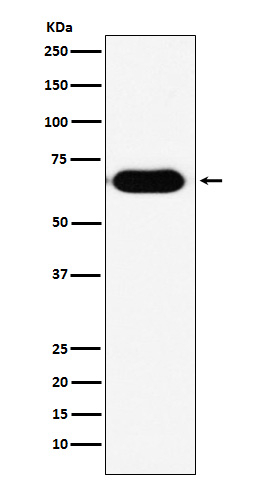 RNF8 Antibody in Western Blot (WB)