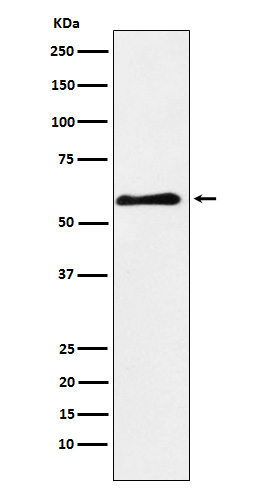 PAK3 Antibody in Western Blot (WB)
