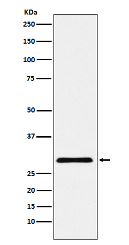 CBX7 Antibody in Western Blot (WB)