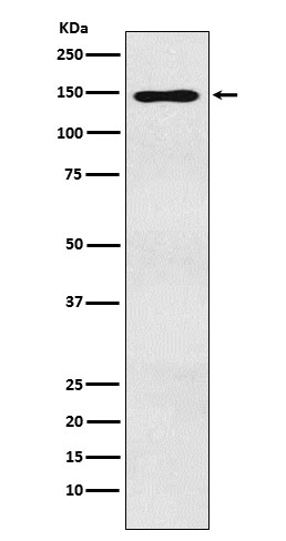 MYBBP1A Antibody in Western Blot (WB)